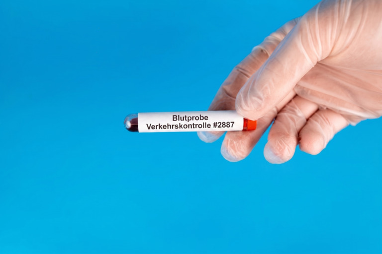Elvanse® im Straßenverkehr: Reagieren Drogentests auf Lisdexamfetamin?